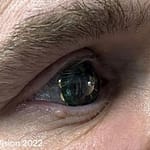 mojo-vision-shows-off-functioning-smart-contact-lens_eqp8.1200.jpg